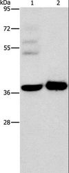 SERPINE2 / Nexin Antibody - Western blot analysis of A172 cell and human fetal brain tissue, using SERPINE2 Polyclonal Antibody at dilution of 1:450.