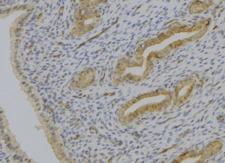 SERPINE2 / Nexin Antibody - 1:100 staining human uterus tissue by IHC-P. The sample was formaldehyde fixed and a heat mediated antigen retrieval step in citrate buffer was performed. The sample was then blocked and incubated with the antibody for 1.5 hours at 22°C. An HRP conjugated goat anti-rabbit antibody was used as the secondary.