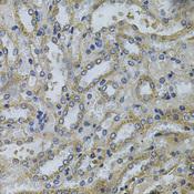 SERPINE2 / Nexin Antibody - Immunohistochemistry of paraffin-embedded Mouse kidney using SERPINE2 Polyclonal Antibody at dilution of 1:100 (40x lens).