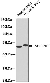 SERPINE2 / Nexin Antibody - Western blot analysis of extracts of various cell lines using SERPINE2 Polyclonal Antibody at dilution of 1:1000.