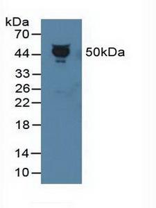 SERPINF1 / PEDF Antibody - Western Blot; Sample: Human Serum.