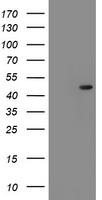 SERPINF1 / PEDF Antibody - HEK293T cells were transfected with the pCMV6-ENTRY control (Left lane) or pCMV6-ENTRY SERPINF1 (Right lane) cDNA for 48 hrs and lysed. Equivalent amounts of cell lysates (5 ug per lane) were separated by SDS-PAGE and immunoblotted with anti-SERPINF1.