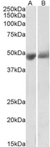 SERPINF1 / PEDF Antibody - Antibody (0.3µg/ml) staining of Human Albumin-depleted Plasma (A) and Serum (B) lysates (35µg protein in RIPA buffer). Primary incubation was 1 hour. Detected by chemiluminescence.