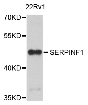 SERPINF1 / PEDF Antibody - Western blot analysis of extract of various cells.