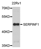 SERPINF1 / PEDF Antibody - Western blot analysis of extract of various cells.