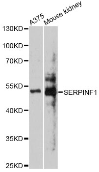 SERPINF1 / PEDF Antibody - Western blot analysis of extracts of various cell lines, using SERPINF1 antibody at 1:1000 dilution. The secondary antibody used was an HRP Goat Anti-Rabbit IgG (H+L) at 1:10000 dilution. Lysates were loaded 25ug per lane and 3% nonfat dry milk in TBST was used for blocking. An ECL Kit was used for detection and the exposure time was 60s.