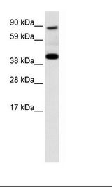 SERPINF1 / PEDF Antibody - Placenta Lysate.  This image was taken for the unconjugated form of this product. Other forms have not been tested.