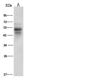 SERPINF1 / PEDF Antibody - Anti-SERPINF1 rabbit polyclonal antibody at 1:500 dilution. Lane A: Rat slpeen tissue lysate. Lysates/proteins at 30 ug per lane. Secondary: Goat Anti-Rabbit IgG (H+L)/HRP at 1/10000 dilution. Developed using the ECL technique. Performed under reducing conditions. Predicted band size: 46 kDa. Observed band size: 49 kDa.
