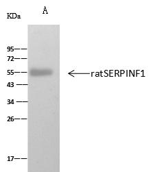 SERPINF1 / PEDF Antibody - ratSERPINF1 was immunoprecipitated using: Lane A: 0.5 mg A549 Whole Cell Lysate. 2 uL anti-ratSERPINF1 rabbit polyclonal antibody and 60 ug of Immunomagnetic beads Protein A/G. Primary antibody: Anti-ratSERPINF1 rabbit polyclonal antibody, at 1:100 dilution. Secondary antibody: Clean-Blot IP Detection Reagent (HRP) at 1:1000 dilution. Developed using the ECL technique. Performed under reducing conditions. Predicted band size: 46 kDa. Observed band size: 52 kDa.