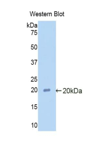 SERPINF2 / Alpha-2-Antiplasmin Antibody - Western blot of recombinant SERPINF2 / Alpha-2-Antiplasmin.  This image was taken for the unconjugated form of this product. Other forms have not been tested.