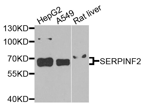 SERPINF2 / Alpha-2-Antiplasmin Antibody - Western blot analysis of extracts of various cells.