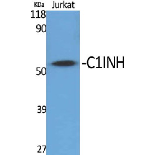SERPING1 / C1 Inhibitor Antibody - Western blot of C1INH antibody