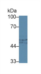 SERPING1 / C1 Inhibitor Antibody