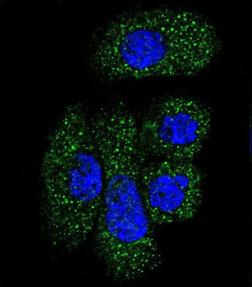 SERPING1 / C1 Inhibitor Antibody - Confocal immunofluorescence of SERPING1 Antibody with NCI-H292 cell followed by Alexa Fluor 488-conjugated goat anti-rabbit lgG (green). DAPI was used to stain the cell nuclear (blue).