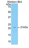SERPING1 / C1 Inhibitor Antibody - Western blot of recombinant SERPING1 / C1 Inhibitor.  This image was taken for the unconjugated form of this product. Other forms have not been tested.