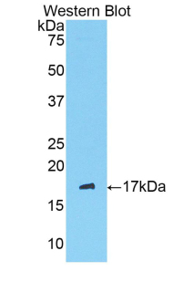 SERPING1 / C1 Inhibitor Antibody - Western blot of recombinant SERPING1 / C1 Inhibitor.  This image was taken for the unconjugated form of this product. Other forms have not been tested.