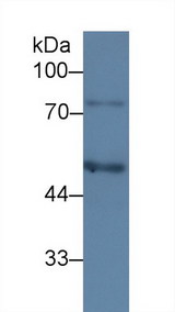 SERPING1 / C1 Inhibitor Antibody - Western Blot; Sample: Human HepG2 cell lysate; Primary Ab: 3µg/ml Mouse Anti-Human C1INH Antibody Second Ab: 0.2µg/mL HRP-Linked Caprine Anti-Mouse IgG Polyclonal Antibody