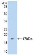 SERPING1 / C1 Inhibitor Antibody - Western Blot; Sample: Recombinant ANXA5, Human.