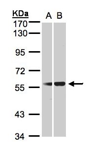 SERPING1 / C1 Inhibitor Antibody - Sample (30 ug whole cell lysate). A:293T, B: HeLa S3. 7.5% SDS PAGE. SERPING1 / C1 Inhibitor antibody diluted at 1:1000