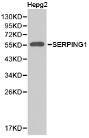 SERPING1 / C1 Inhibitor Antibody - Western blot of extracts of HepG2 cell lines, using SERPING1 antibody.
