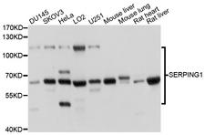 SERPING1 / C1 Inhibitor Antibody - Western blot analysis of extracts of various cell lines, using SERPING1 antibody at 1:1000 dilution. The secondary antibody used was an HRP Goat Anti-Rabbit IgG (H+L) at 1:10000 dilution. Lysates were loaded 25ug per lane and 3% nonfat dry milk in TBST was used for blocking. An ECL Kit was used for detection and the exposure time was 3s.