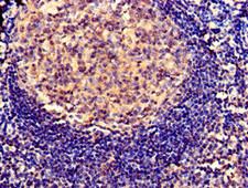 SERPING1 / C1 Inhibitor Antibody - Immunohistochemistry of paraffin-embedded human tonsil tissue using SERPING1 Antibody at dilution of 1:100