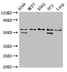 SERPING1 / C1 Inhibitor Antibody - Western Blot Positive WB detected in: A549 whole cell lysate, MCF-7 whole cell lysate, K562 whole cell lysate, PC-3 whole cell lysate, Rat lung tissue All lanes: SERPING1 antibody at 2µg/ml Secondary Goat polyclonal to rabbit IgG at 1/50000 dilution Predicted band size: 56, 50 kDa Observed band size: 56 kDa