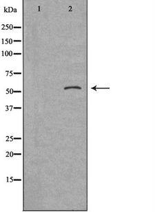 SERPING1 / C1 Inhibitor Antibody - Western blot analysis of extracts of HuvEc cells using SERPING1 antibody. The lane on the left is treated with the antigen-specific peptide.