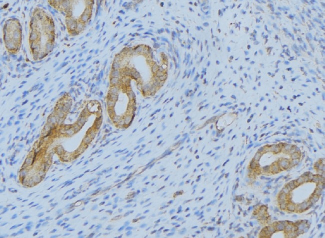 SERPING1 / C1 Inhibitor Antibody - 1:100 staining human uterus tissue by IHC-P. The sample was formaldehyde fixed and a heat mediated antigen retrieval step in citrate buffer was performed. The sample was then blocked and incubated with the antibody for 1.5 hours at 22°C. An HRP conjugated goat anti-rabbit antibody was used as the secondary.