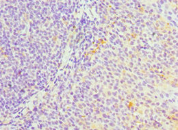 SERPINH1 / HSP47 Antibody - Immunohistochemistry of paraffin-embedded human tonsil tissue using SERPINH1 Antibody at dilution of 1:100