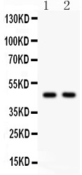 SERPINH1 / HSP47 Antibody - Hsp47 antibody Western blot. All lanes: Anti Hsp47 at 0.5 ug/ml. Lane 1: U87 Whole Cell Lysate at 40 ug. Lane 2: A549 Whole Cell Lysate at 40 ug. Predicted band size: 47 kD. Observed band size: 47 kD.