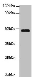 SERPINH1 / HSP47 Antibody - Western blot All lanes: Serpinh1 antibody at 6µg/ml + Jurkat whole cell lysate Secondary Goat polyclonal to rabbit IgG at 1/10000 dilution Predicted band size: 47 kDa Observed band size: 47 kDa