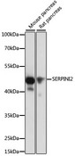 SERPINI2 / PANCPIN Antibody - Western blot analysis of extracts of various cell lines, using SERPINI2 antibody at 1:1000 dilution. The secondary antibody used was an HRP Goat Anti-Rabbit IgG (H+L) at 1:10000 dilution. Lysates were loaded 25ug per lane and 3% nonfat dry milk in TBST was used for blocking. An ECL Kit was used for detection and the exposure time was 10s.