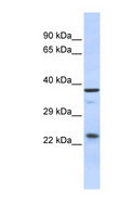 SERTAD1 / TRIP-Br1 / SEI-1 Antibody - SERTAD1 antibody Western blot of Fetal Muscle lysate. This image was taken for the unconjugated form of this product. Other forms have not been tested.