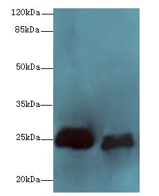 SERTAD1 / TRIP-Br1 / SEI-1 Antibody - Western blot. All lanes: SERTAD1 antibody at 6 ug/ml. Lane 1: SH-SY5Y whole cell lysate. Lane 2: A549 whole cell lysate. Secondary Goat polyclonal to Rabbit IgG at 1:10000 dilution. Predicted band size: 25 kDa. Observed band size: 25 kDa.