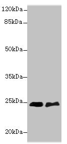 SERTAD1 / TRIP-Br1 / SEI-1 Antibody - Western blot All lanes: SERTAD1 antibody at 6µg/ml Lane 1: SH-SY5Y whole cell lysate Lane 2: A549 whole cell lysate Secondary Goat polyclonal to rabbit IgG at 1/10000 dilution Predicted band size: 25 kDa Observed band size: 25 kDa