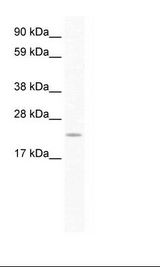 SERTAD1 / TRIP-Br1 / SEI-1 Antibody - Placenta Lysate.  This image was taken for the unconjugated form of this product. Other forms have not been tested.