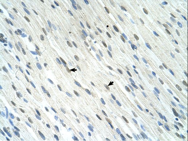 SERTAD1 / TRIP-Br1 / SEI-1 Antibody - SERTAD1 antibody SERTAD1(SERTA domain containing 1) Antibody was used in IHC to stain formalin-fixed, paraffin-embedded human muscle.  This image was taken for the unconjugated form of this product. Other forms have not been tested.