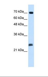 SERTAD1 / TRIP-Br1 / SEI-1 Antibody - Jurkat cell lysate. Antibody concentration: 5.0 ug/ml. Gel concentration: 12%.  This image was taken for the unconjugated form of this product. Other forms have not been tested.
