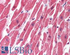 SERTAD1 / TRIP-Br1 / SEI-1 Antibody - Anti-SERTAD1 antibody IHC of human heart. Immunohistochemistry of formalin-fixed, paraffin-embedded tissue after heat-induced antigen retrieval. Antibody concentration 5 ug/ml.  This image was taken for the unconjugated form of this product. Other forms have not been tested.