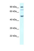 SESN2 / HI95 Antibody - SESN2 antibody Western blot of Fetal Heart lysate. Antibody concentration 1 ug/ml.  This image was taken for the unconjugated form of this product. Other forms have not been tested.