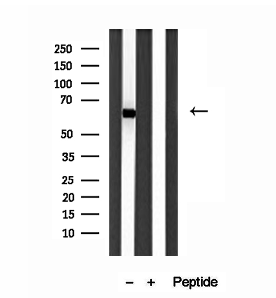 SESN2 / HI95 Antibody - Western blot analysis of extracts of HEK293 cells using Sestrin 2 antibody.