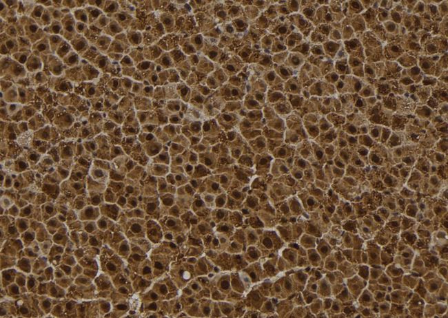 SESN2 / HI95 Antibody - 1:100 staining rat liver tissue by IHC-P. The sample was formaldehyde fixed and a heat mediated antigen retrieval step in citrate buffer was performed. The sample was then blocked and incubated with the antibody for 1.5 hours at 22°C. An HRP conjugated goat anti-rabbit antibody was used as the secondary.