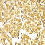 SESN2 / HI95 Antibody - Immunohistochemistry of paraffin-embedded human gastric tissue.
