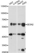 SESN2 / HI95 Antibody - Western blot analysis of extracts of various cell lines, using SESN2 antibody at 1:3000 dilution. The secondary antibody used was an HRP Goat Anti-Rabbit IgG (H+L) at 1:10000 dilution. Lysates were loaded 25ug per lane and 3% nonfat dry milk in TBST was used for blocking. An ECL Kit was used for detection and the exposure time was 90s.