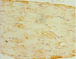 SESN3 Antibody - Immunohistochemistry of paraffin-embedded human skeletal muscle using antibody at 1:100 dilution.