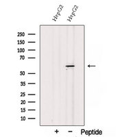 SESN3 Antibody - Western blot analysis of extracts of COS-7 cells using SESN3 antibody. The lane on the left was treated with blocking peptide.