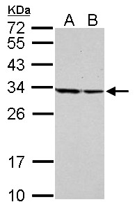 SET / TAF-I Antibody - Sample (30 ug of whole cell lysate). A: Raji, B: THP-1. 12% SDS PAGE. SET antibody diluted at 1:10000.