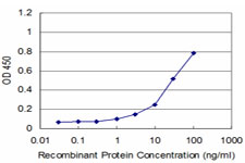 SET / TAF-I Antibody - Detection limit for recombinant GST tagged SET is approximately 3 ng/ml as a capture antibody.