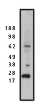 SET / TAF-I Antibody - Western blot of SET antibody on HeLa cell lysate (15 ug/lane). Primary antibody used at 1 ug/ml. Secondary antibody used at 1:50k dilution. 
